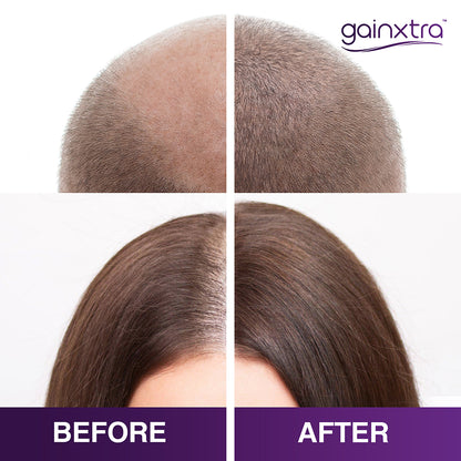 5% Minoxidil Hair Regrowth Treatment Spray