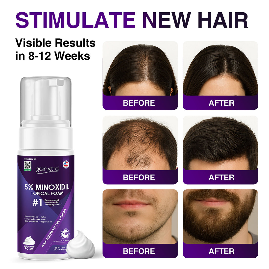 5% Minoxidil Topical Foam