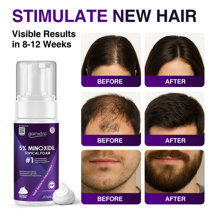 5% Minoxidil Topical Foam